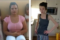 Gái xinh thành xác sống vì uống 90 viên thuốc giảm cân