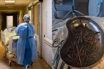 Lấy hơn 1 kg đinh và ốc vít khỏi dạ dày người đàn ông