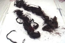 Bật nắp quan tài, phát hiện nguyên nhân hoàng đế Quang Tự đột tử