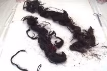 Bật nắp quan tài, phát hiện nguyên nhân hoàng đế Quang Tự đột tử