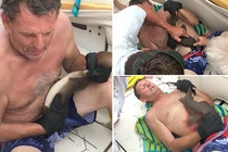 Đụng trúng sinh vật này, người đàn ông bị “thủng” một lỗ ngay bụng