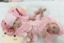 Những ca phẫu thuật song sinh dính liền nổi tiếng trong y học Việt Nam