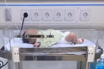 Nụ hôn khiến bé sơ sinh nhập viện, những tiếp xúc nào cần tránh?