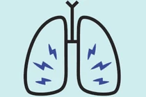 9 dấu hiệu của bệnh ung thư phổi bạn cần lưu ý