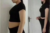 Tác hại kinh hoàng của việc giảm cân nhanh khiến cô gái hôn mê