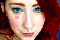 Trào lưu xăm nhãn cầu khiến cô gái suýt mù nguy hiểm ra sao?