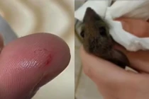 Bị chuột cắn, nữ sinh cắn lại để trả thù gây choáng