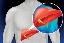 Những dấu hiệu cơ thể tiết lộ sức khỏe lá gan 