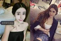 Nhan sắc bỗng nhiên xinh đẹp nhờ thẩm mỹ của “hot girl mặt rắn” Trung Quốc