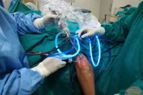 Kinh hoàng 200 "hạt trân châu" trắng sữa lổn nhổn trong khớp tay nam thanh niên