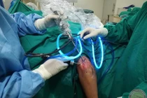 Kinh hoàng 200 "hạt trân châu" trắng sữa lổn nhổn trong khớp tay nam thanh niên