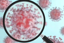 6 cụm triệu chứng COVID-19 dự báo trước bệnh nặng hay nhẹ