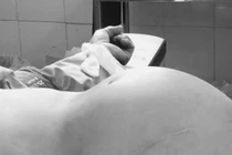 Kinh hoàng cụ bà U70 mang quái u gần 4kg chứa bã đậu, xương và tóc