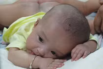 Rưng rưng hình ảnh từ phút chào đời tới khi tách rời của cặp song sinh dính liền