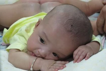 Rưng rưng hình ảnh từ phút chào đời tới khi tách rời của cặp song sinh dính liền