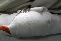 Đắk Nông: Tranh chấp đất rẫy, cô giáo bị chồng cũ chém gần đứt lìa 2 bàn tay