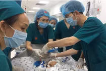 Ca mổ 12 giờ tách rời cặp song sinh dính liền thành công đi vào lịch sử