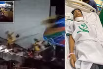 Bị văng khỏi đu quay, cậu bé 13 tuổi phải cắt một bên phổi