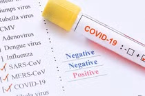 Bộ kit test COVID-19 Hà Nội dùng ở các trạm xét nghiệm nhanh độ tin cậy thế nào?