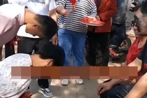 Chú rể 20 tuổi lấy cô dâu 35 tuổi bị thiểu năng gây tranh cãi