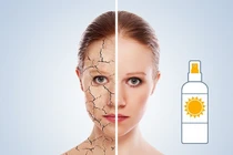 8 bí quyết chăm sóc da hoàn hảo từ chuyên gia da liễu