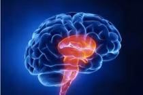 Thói quen trong quan hệ tình dục khiến cô gái 24 tuổi bị nhồi máu não