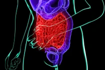 Ung thư bàng quang của nhạc sĩ 'Về đây nghe em”... triệu chứng, phòng ngừa?