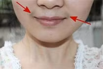 Bắt bệnh “vùng kín” qua các dấu hiệu dễ thấy trên khuôn mặt