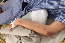 Cô gái Yên Bái bị hành hung suốt 2 giờ trong nhà: Công an nói gì?