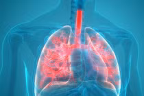 Nam sinh lớp 10 tử vong vì lao ruột: Bệnh nguy hiểm ra sao?