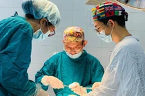 Áo chống nắng cuốn vào bánh xe, nữ sinh tổn thương mặt nghiêm trọng