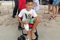 Cậu bé 8 tuổi sống sót nhờ dùng tay đấm vào mặt cá mập