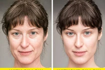 Ngủ không dùng gối: Điều kỳ diệu gì xảy ra với làn da?