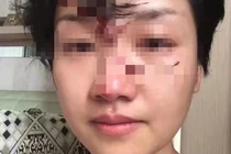 Bạo hành vợ suốt 7 năm, phó giáo sư đại học bị cấm giảng dạy