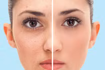 5 điều kỳ diệu xảy ra khi bạn tắm bằng nước lạnh