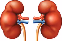 Những dấu hiệu cảnh báo ban đầu của bệnh sỏi thận