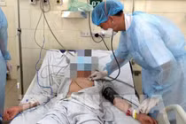 Thanh niên 17 tuổi mắc sốt xuất huyết tử vong: Cách điều trị nào chuẩn?