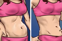 Chướng bụng, đầy hơi cảnh báo 6 vấn đề sức khỏe nghiêm trọng sau