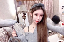 Thảm họa thẩm mỹ: Cô gái hóa “mặt rắn” sau 60 lần “dao kéo”