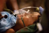 Con trai 9 tuổi ung thư thận, mẹ khóc ngất khi biết nguyên nhân là món ăn sáng quen