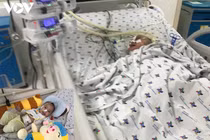 Bé trai 6 tháng tuổi nguy kịch vì hóc xương lươn: Ăn dặm an toàn?