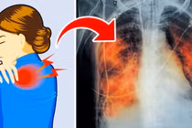 5 dấu hiệu báo động phổi bạn đang có vấn đề