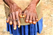 Bộ lạc có hủ tục cắt đốt ngón tay khi người thân mất