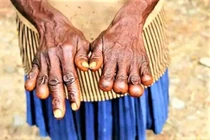 Bộ lạc có hủ tục cắt đốt ngón tay khi người thân mất