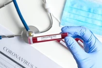 4 bệnh nhân COVID-19 tái dương tính sau nhiều lần âm tính: Bác sĩ nói gì?