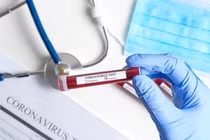 4 bệnh nhân COVID-19 tái dương tính sau nhiều lần âm tính: Bác sĩ nói gì?