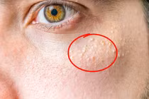 8 dấu hiệu khuôn mặt bạn đang lão hóa nhanh hơn tuổi thật