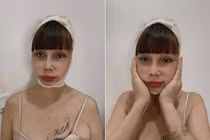 Gương mặt biến dạng kinh hoàng vì “dao kéo” của cô dâu 62 tuổi