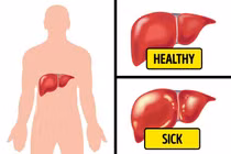Chứng đầy hơi có thể là dấu hiệu 6 căn bệnh nguy hiểm cần cảnh giác