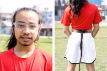 Chàng trai 16 tuổi “nổi như cồn” vì mọc chiếc đuôi dài 70 cm